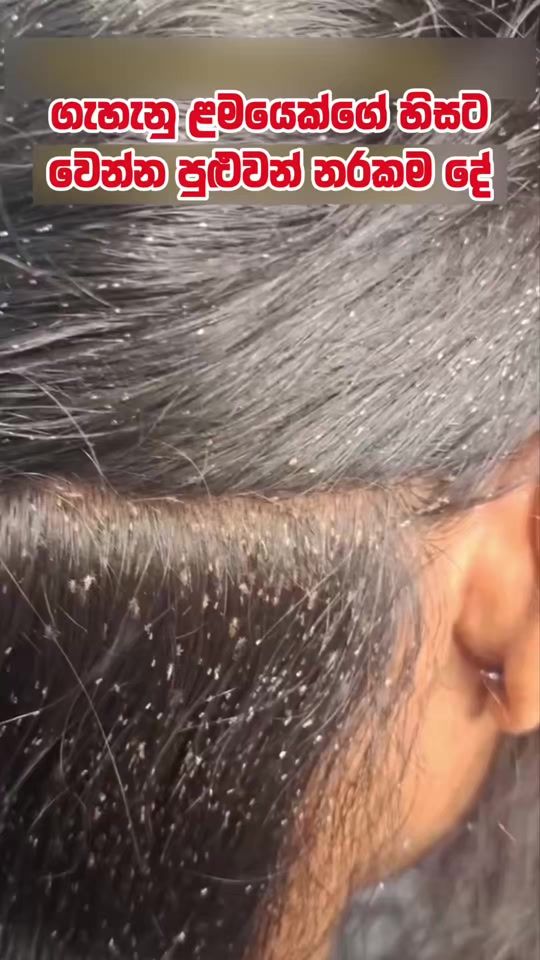 TikTok video thumbnail by lassana_rahas