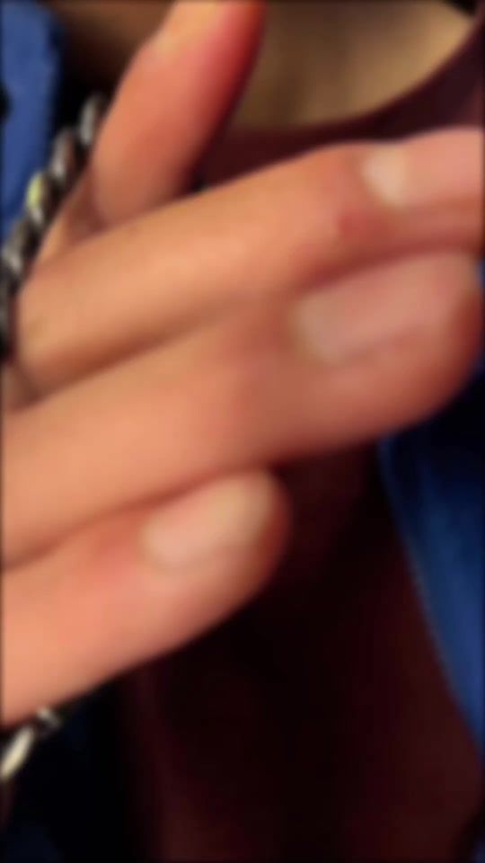 TikTok video thumbnail by fxstarting