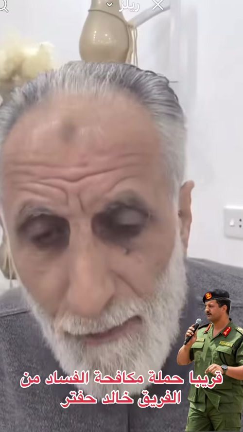 TikTok video thumbnail by aymannagm677