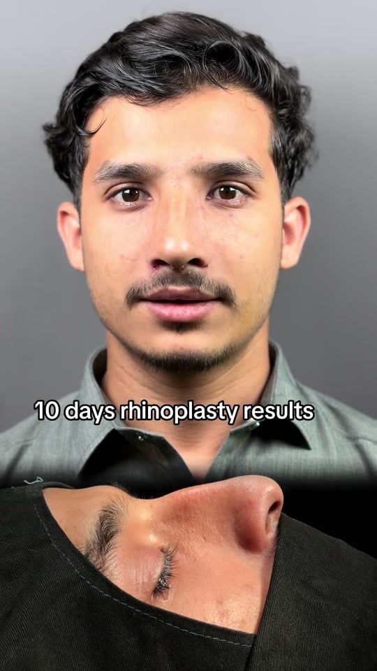 TikTok video thumbnail by ibrar_ent