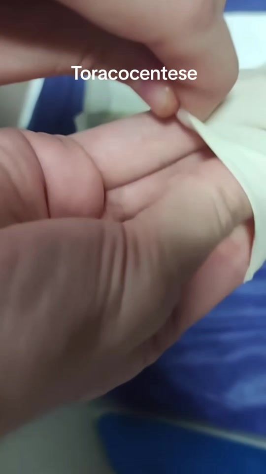 TikTok video thumbnail by saudepedecarona