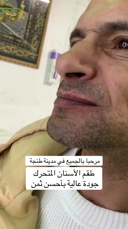 TikTok video thumbnail by elkkhamlichidental
