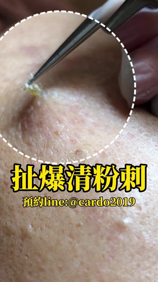 TikTok video thumbnail by cardo2014