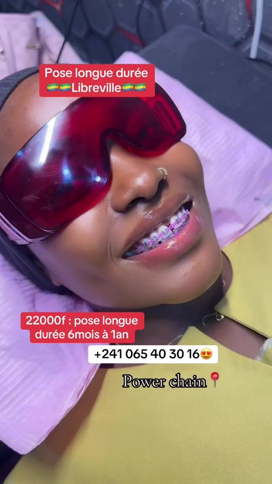 TikTok video thumbnail by mg.braces237