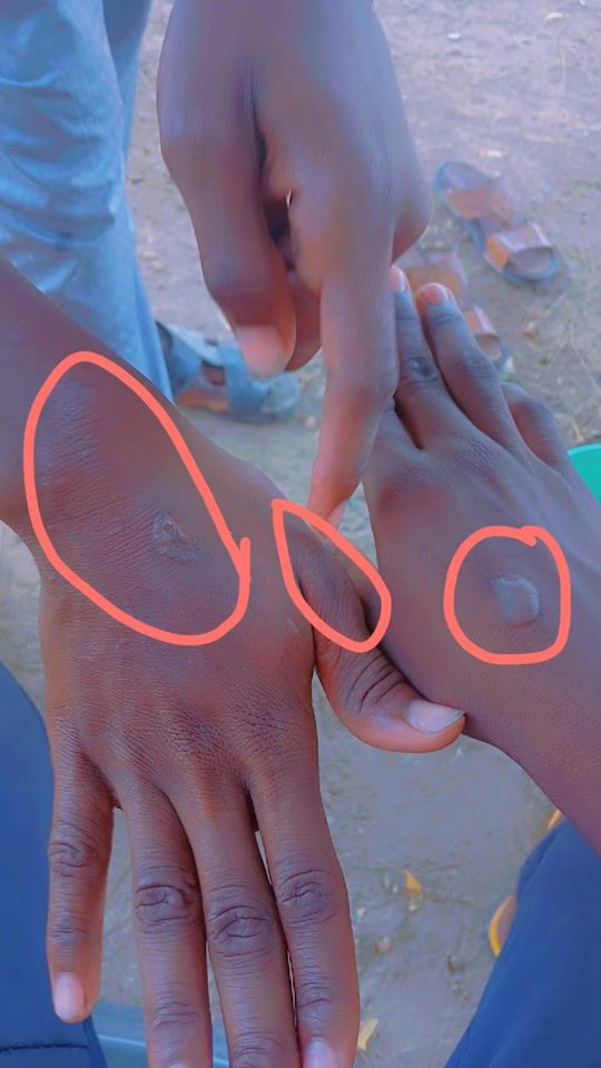 TikTok video thumbnail by abakarsinine10