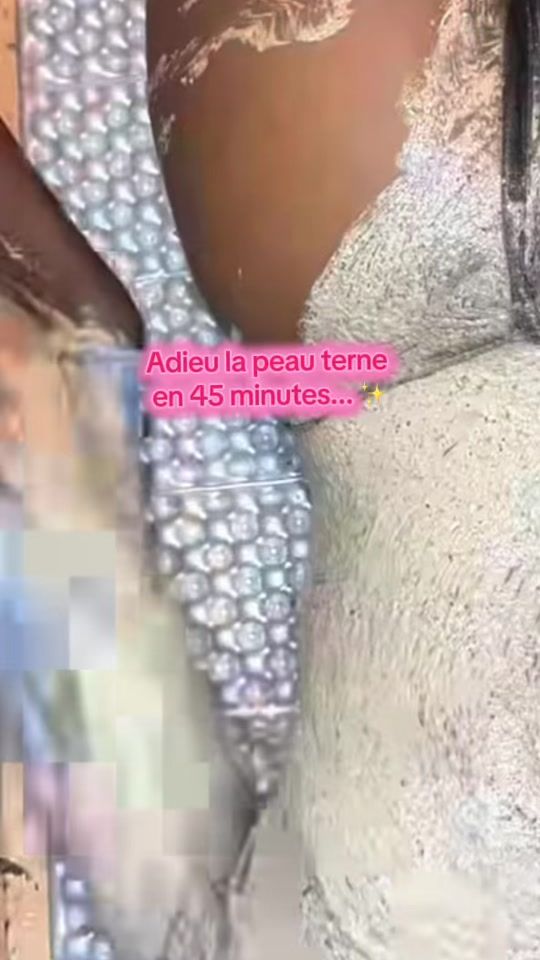 TikTok video thumbnail by docteur.bellepeau