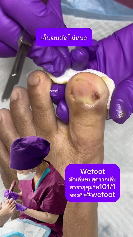 TikTok video thumbnail by wefoot8
