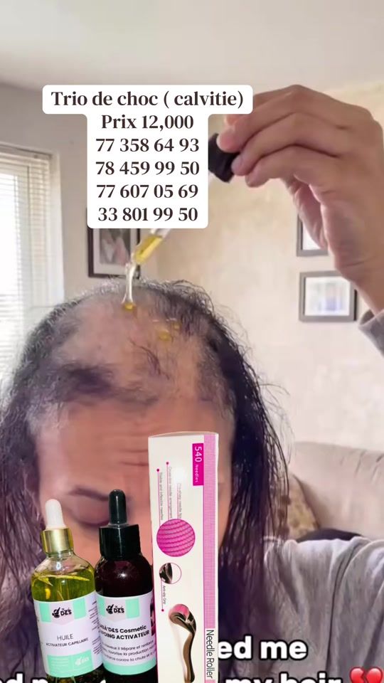 TikTok video thumbnail by bamba.d2s