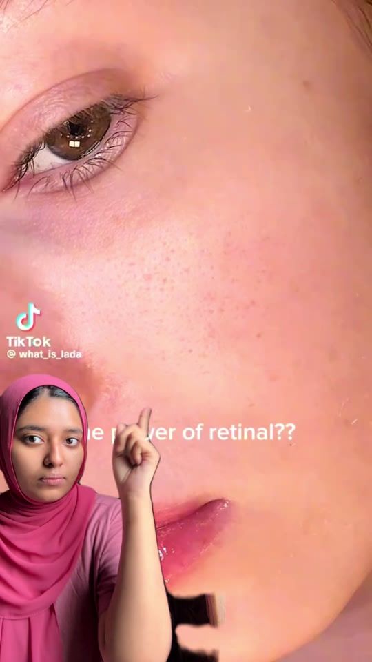 TikTok video thumbnail by __badami_konna__