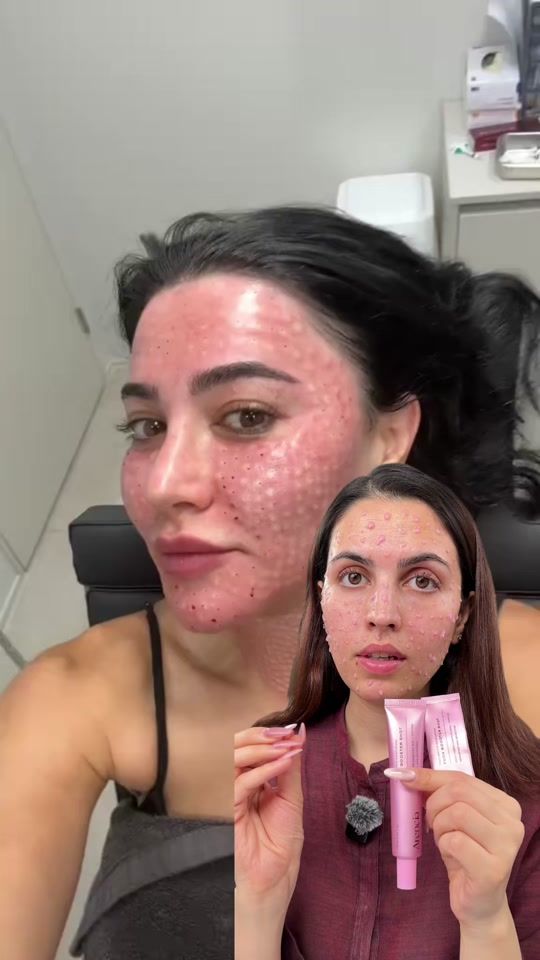 TikTok video thumbnail by maryamkhorami
