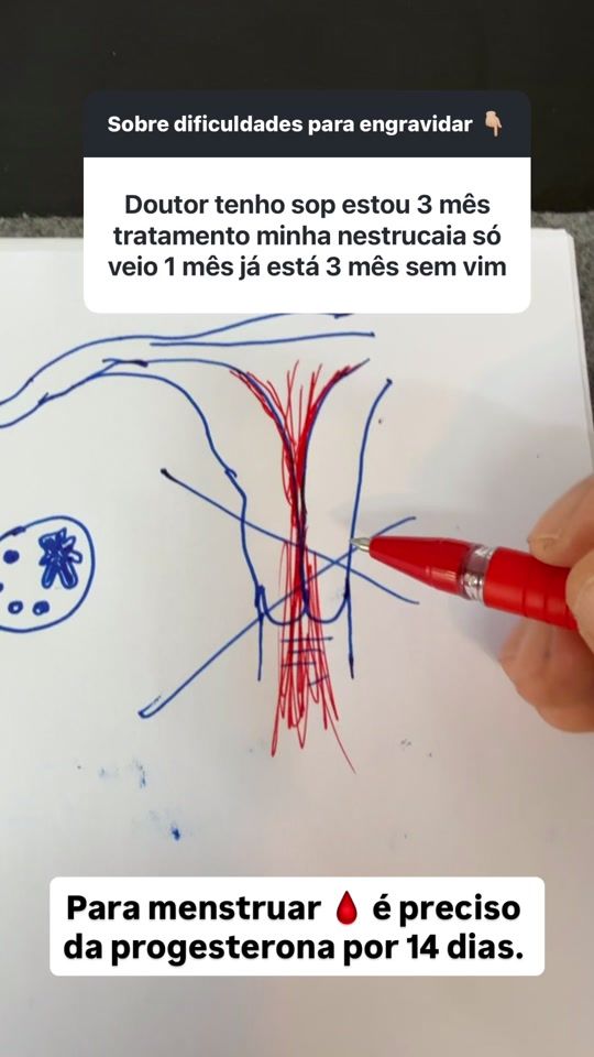 TikTok video thumbnail by dr.michelpalheta