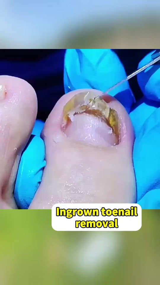 TikTok video thumbnail by pedirelief