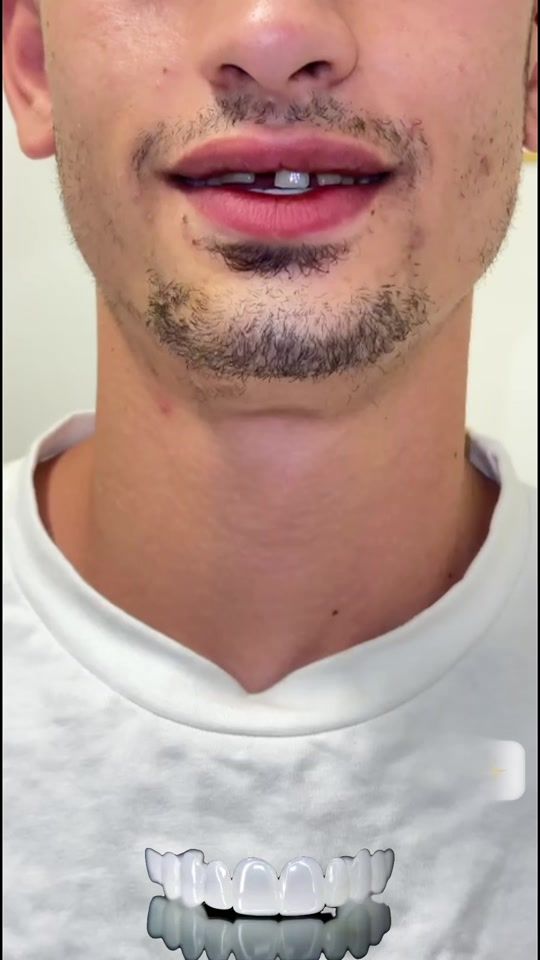 TikTok video thumbnail by dr.muhammad.mostafa
