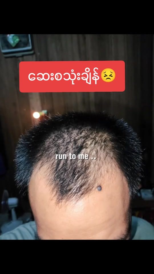 TikTok video thumbnail by khinlay.khk