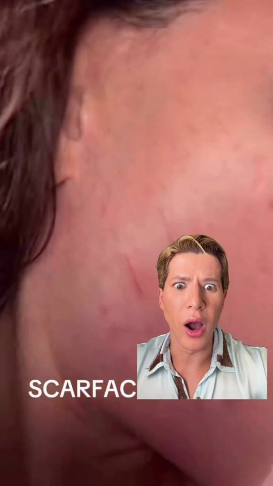 TikTok video thumbnail by mi.gguel_