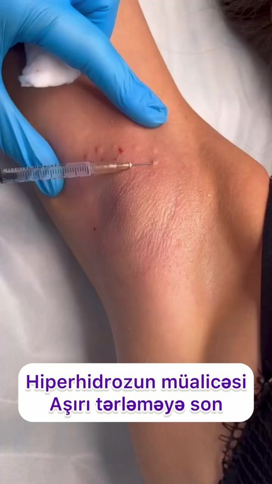 TikTok video thumbnail by dr.parvanarzayeva