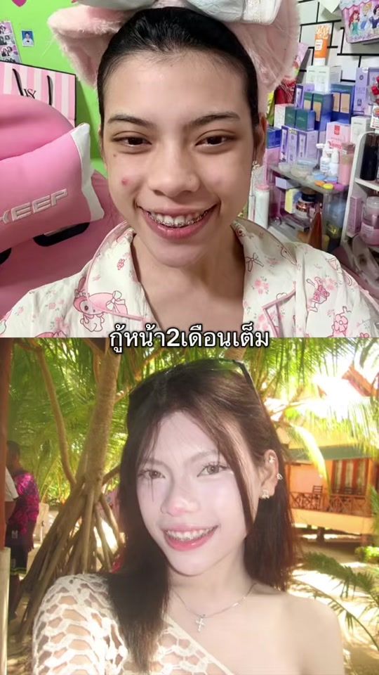 TikTok video thumbnail by prae_wa1705