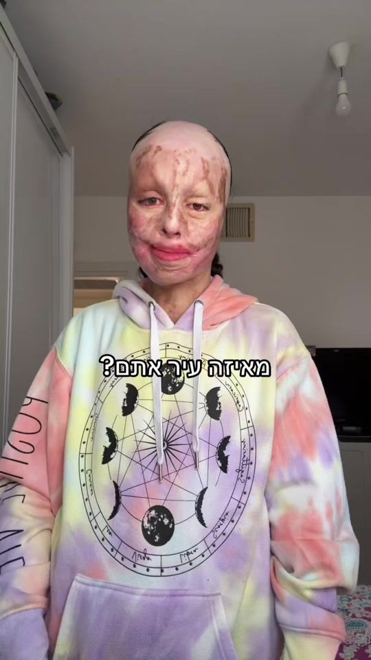TikTok video thumbnail by ravidsulam_