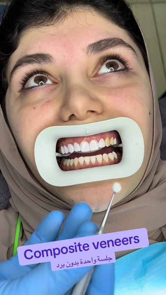 TikTok video thumbnail by clinics2020