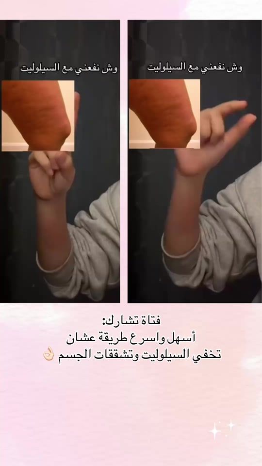 TikTok video thumbnail by artejoaa.us