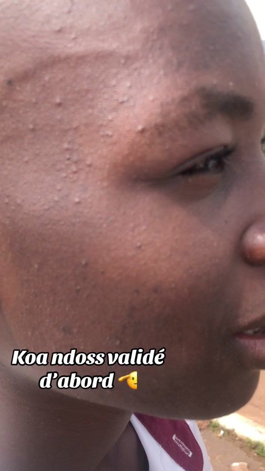 TikTok video thumbnail by rolex.le.mec.sensi