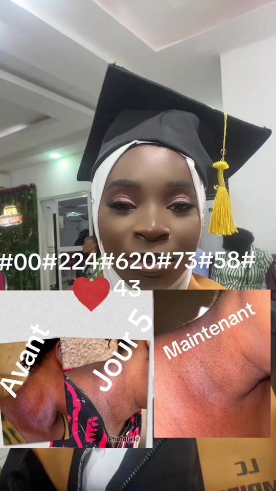 TikTok video thumbnail by fatimashop75