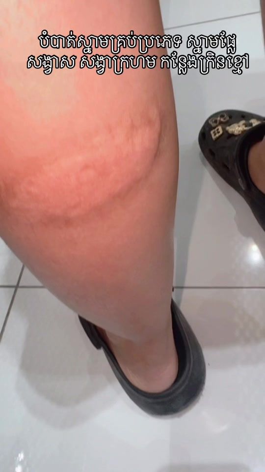 TikTok video thumbnail by skincarehour2