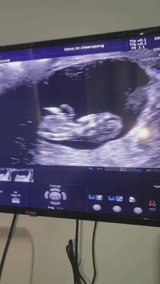 TikTok video thumbnail by sanook237