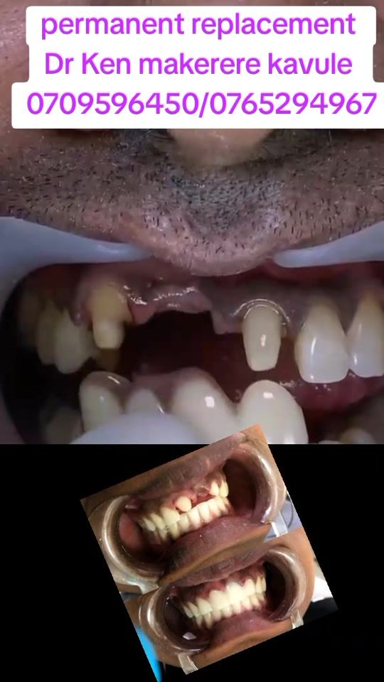 TikTok video thumbnail by kenny25dr