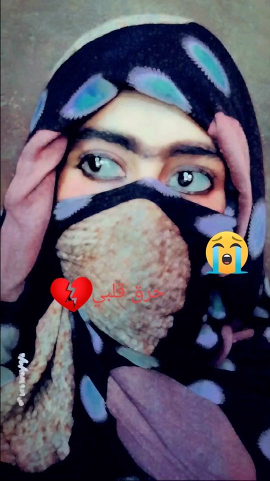 TikTok video thumbnail by bat.alruv
