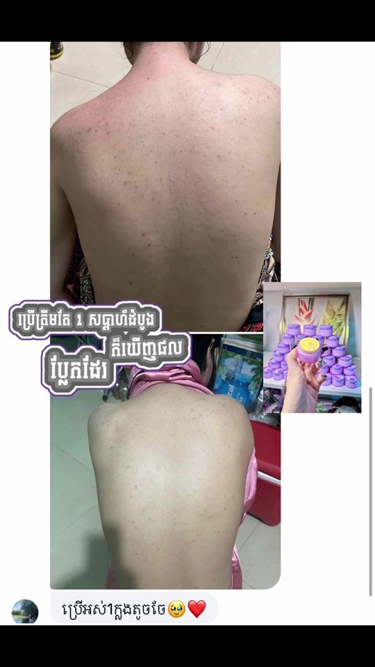 TikTok video thumbnail by socheata_chea
