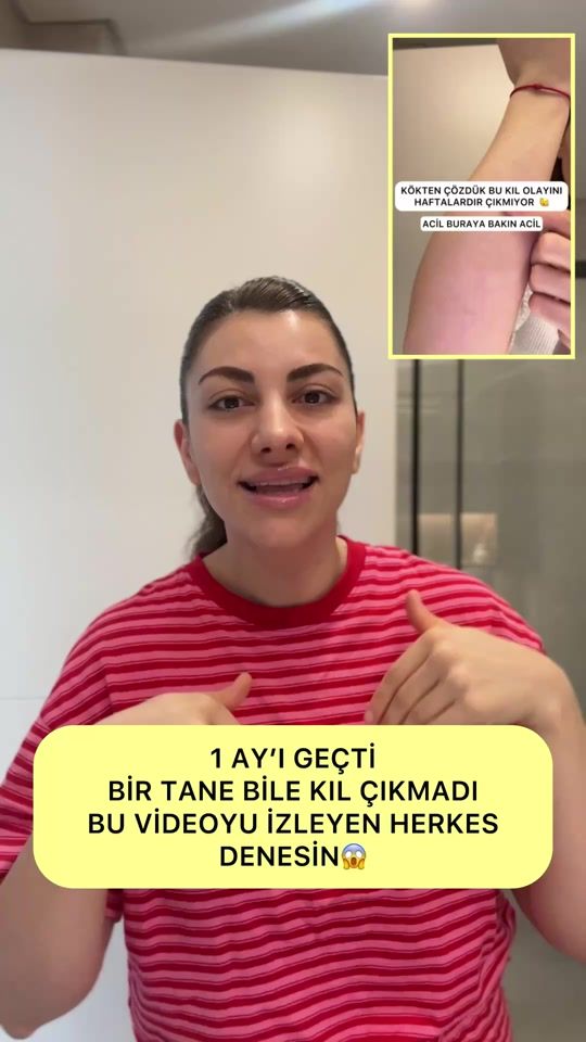 TikTok video thumbnail by tugceay__