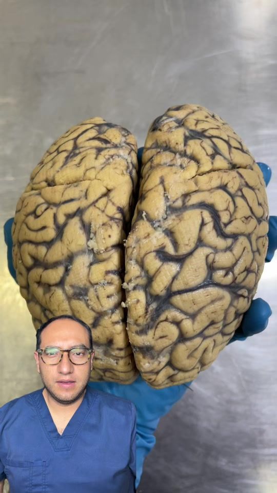 TikTok video thumbnail by dr.giogalindo
