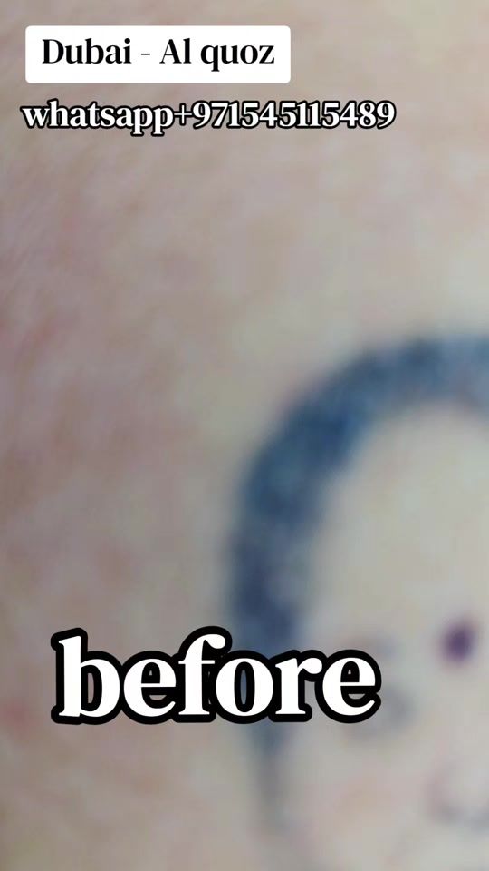 TikTok video thumbnail by rn_tattooist