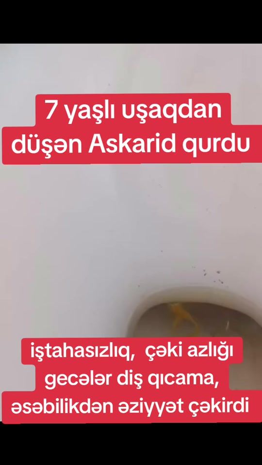 TikTok video thumbnail by eliyevaa.122