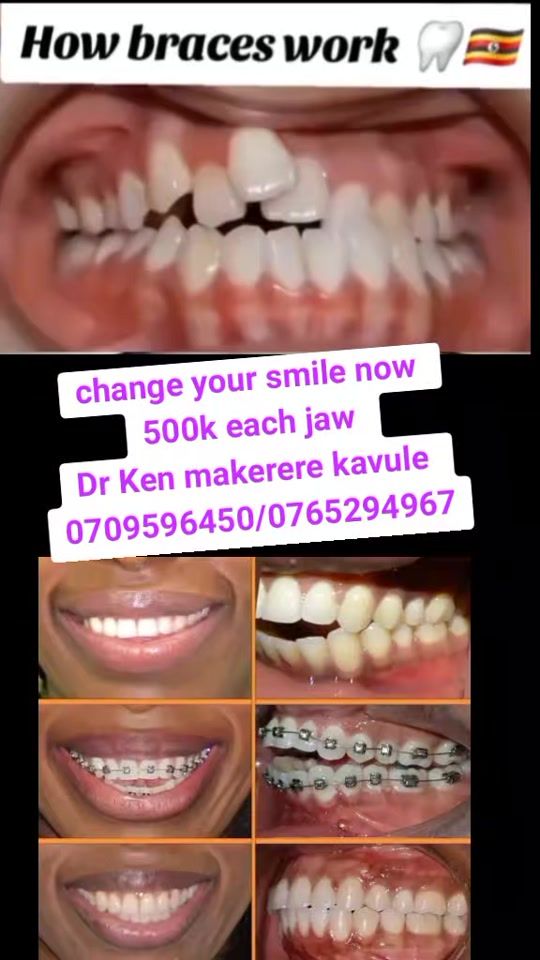 TikTok video thumbnail by kenny25dr