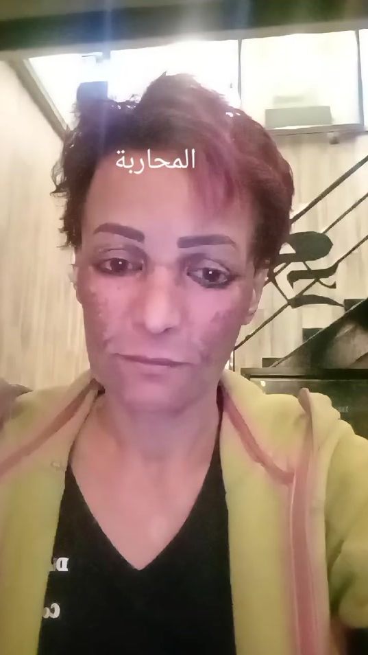 TikTok video thumbnail by dr.emna.psy.psych
