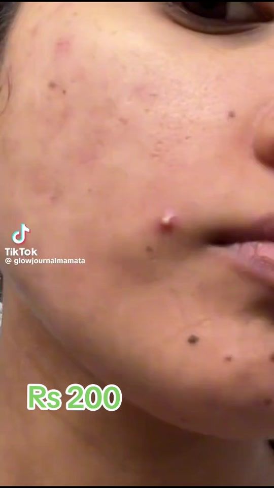 TikTok video thumbnail by treasure.corner85