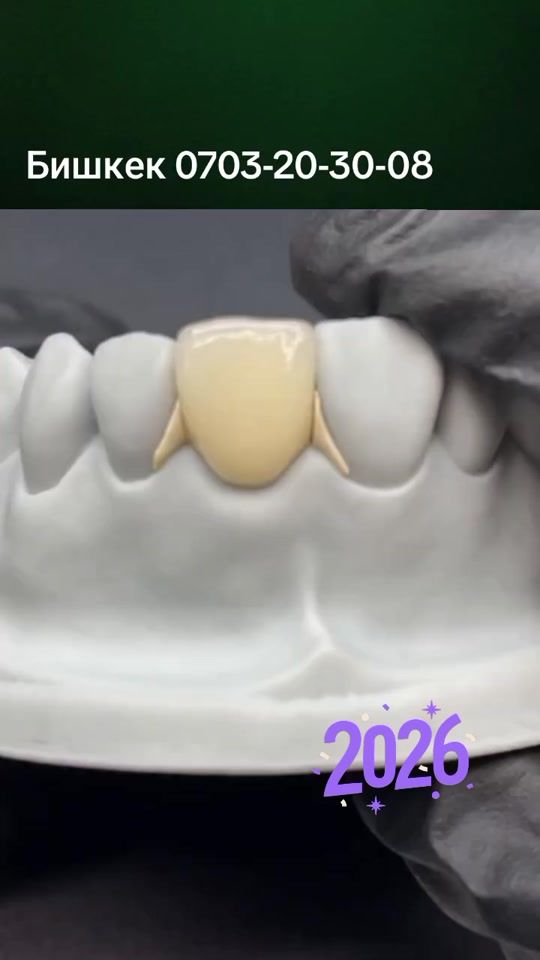 TikTok video thumbnail by stomologist