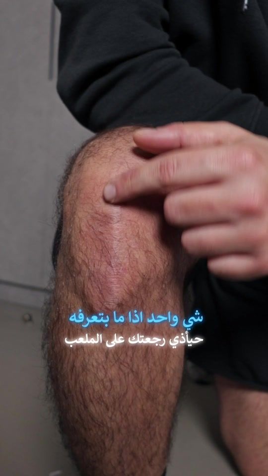 TikTok video thumbnail by drronimosleh