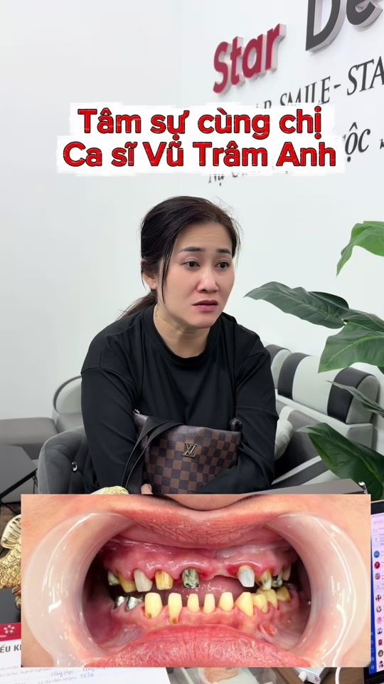 TikTok video thumbnail by truongngoc_dental
