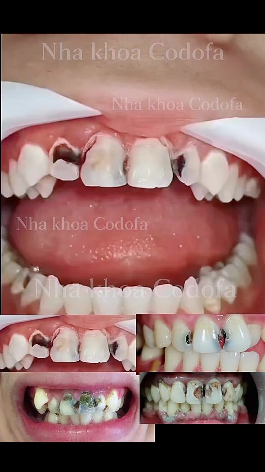 TikTok video thumbnail by nhakhoa_codofa