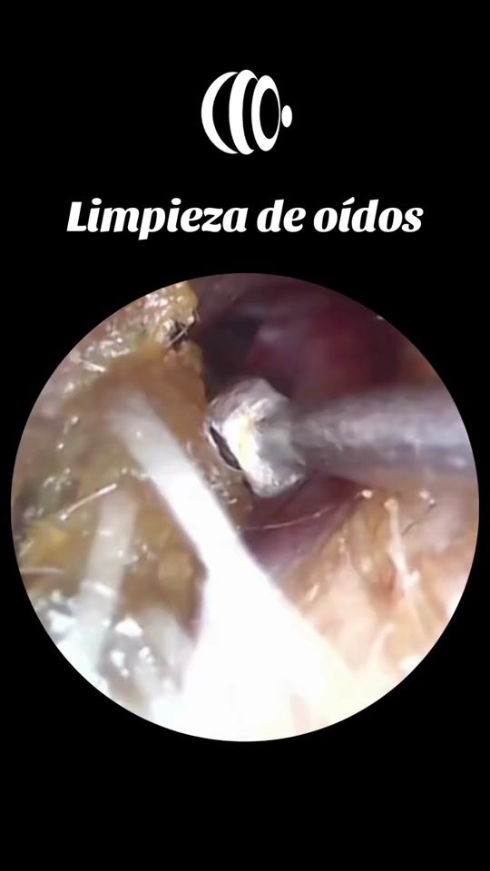 TikTok video thumbnail by drateresita