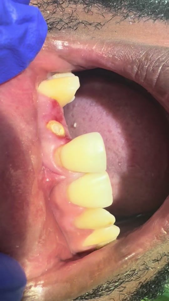 TikTok video thumbnail by 15npolyclinic