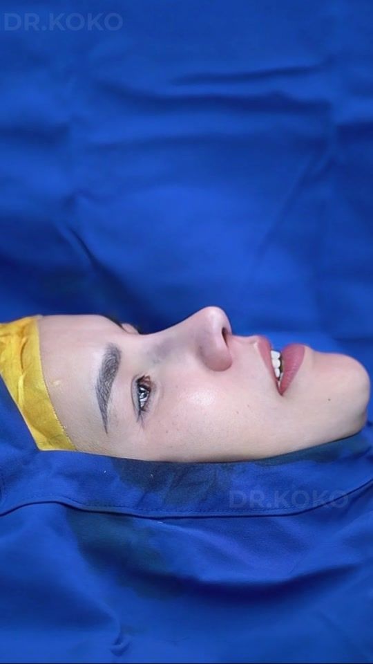 TikTok video thumbnail by dr.kokomd