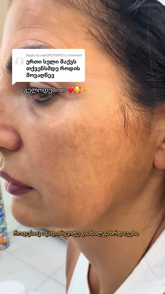 TikTok video thumbnail by estheticline