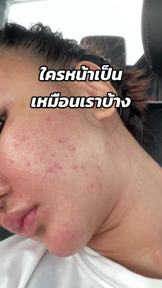 TikTok video thumbnail by hoyon.brand