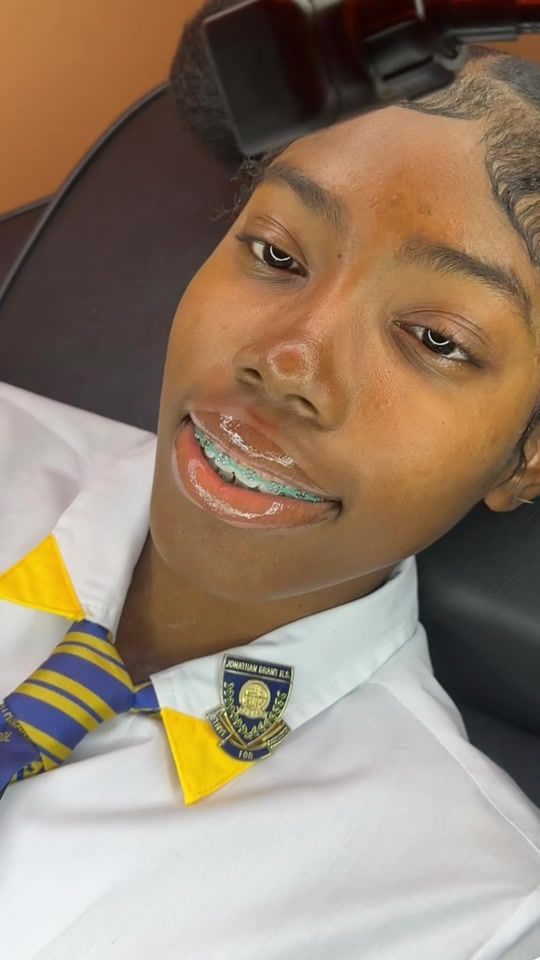 TikTok video thumbnail by stormie.braces