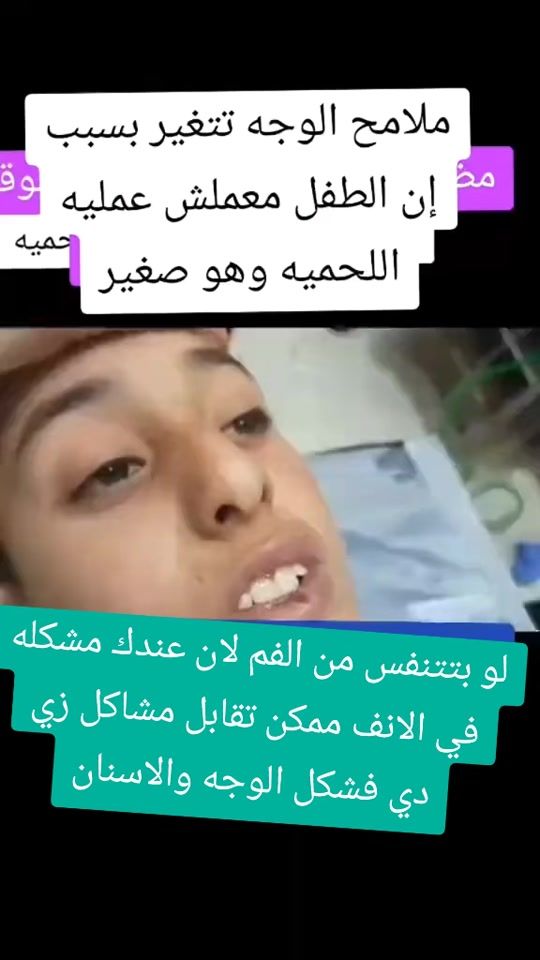 TikTok video thumbnail by ahmadzhzahy