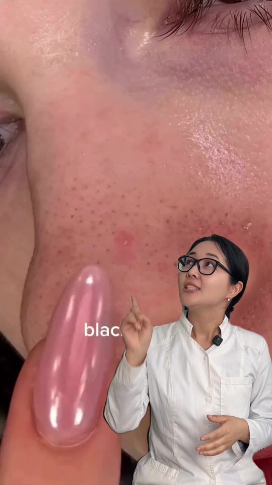 TikTok video thumbnail by dr.sagynbaeva_cosmetics